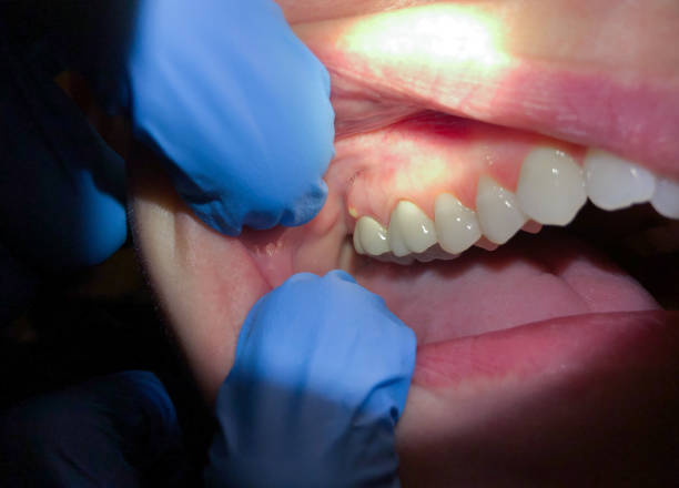 Best Emergency Dental Care for Trauma or Injury in Dardenne Prairie, MO